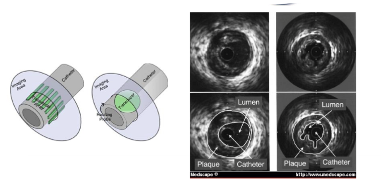 <ol><li><p>multi or single element transducer</p></li><li><p>transducers can rotate or use an acoustic mirror</p></li></ol><p></p>