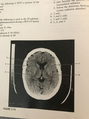 <p>Which number on the figure corresponds to the septum pellucidum?</p><p>A) 2</p><p>B) 3</p><p>C) 4</p><p>D) 5</p>