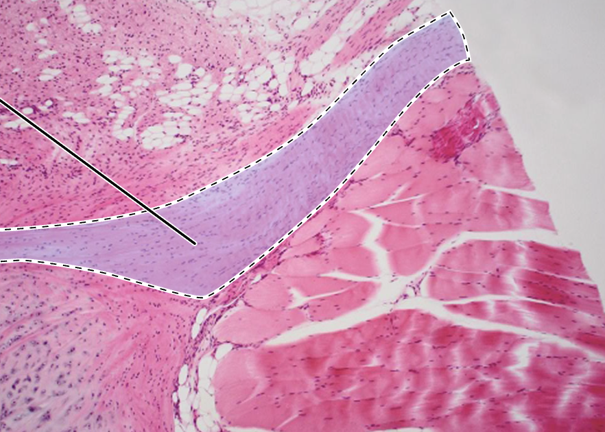 <p>highlighted tissue?</p>