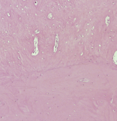 <p>Identify bone type(s)</p>