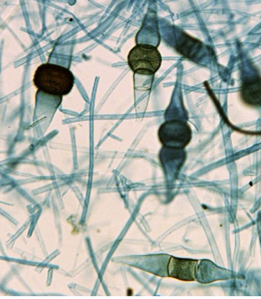 <p>Is this a photo of sporangia or zygosporangia?</p>