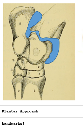 <p>Tibiotarsal Jt - Plantar Approach</p>