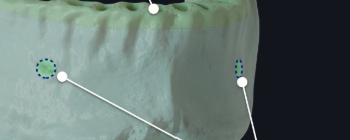 <p>What is this pointing to? What bone is it on?</p>