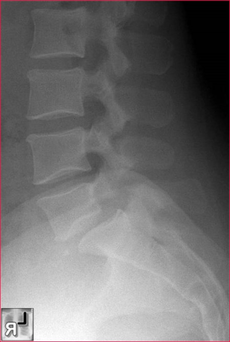 <p>What is the diagnosis?</p>
