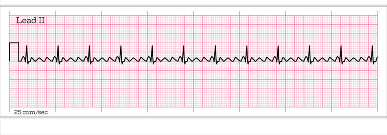 <p>What is this rhythm?</p>