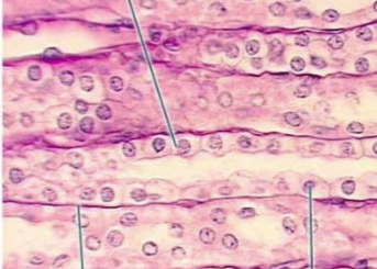 <p>what tissue type is this</p>