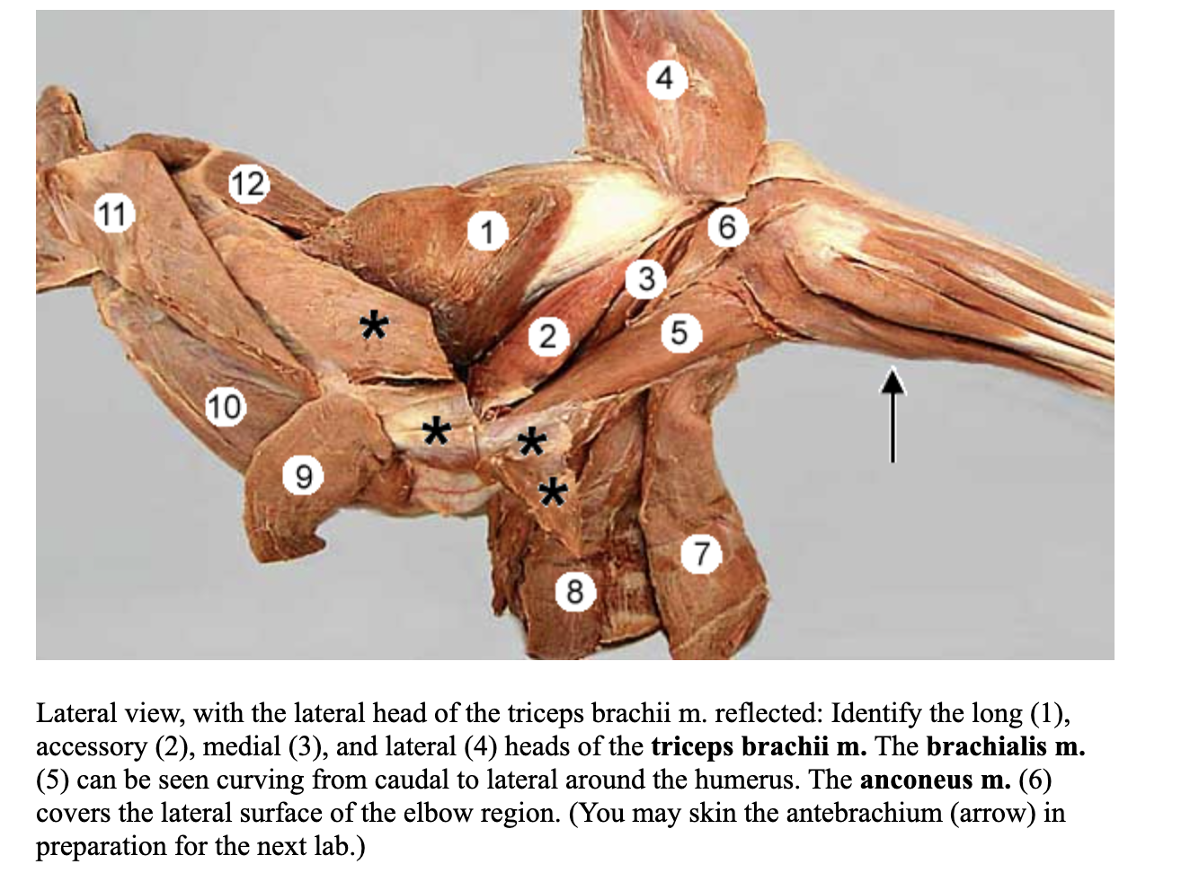 <p>attachments: long head: caudal border of the scapula to tuber olecrani</p><p>lateral head: tricipital line of humerus to tuber olecrani</p><p>medial head: crest of the lesser tubercle to tuber olecrani </p><p>accessory head: neck of the humerus to tuber olecranni </p><p>action: all heads extend the elbow joing; long head also flexes shoulder joint </p>