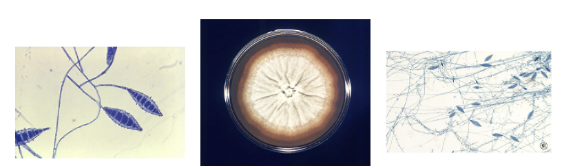 <p>ID this mold </p>
