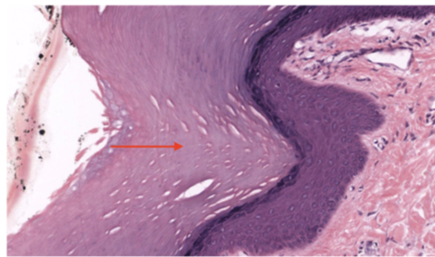 <p>Identify the specific layer</p>