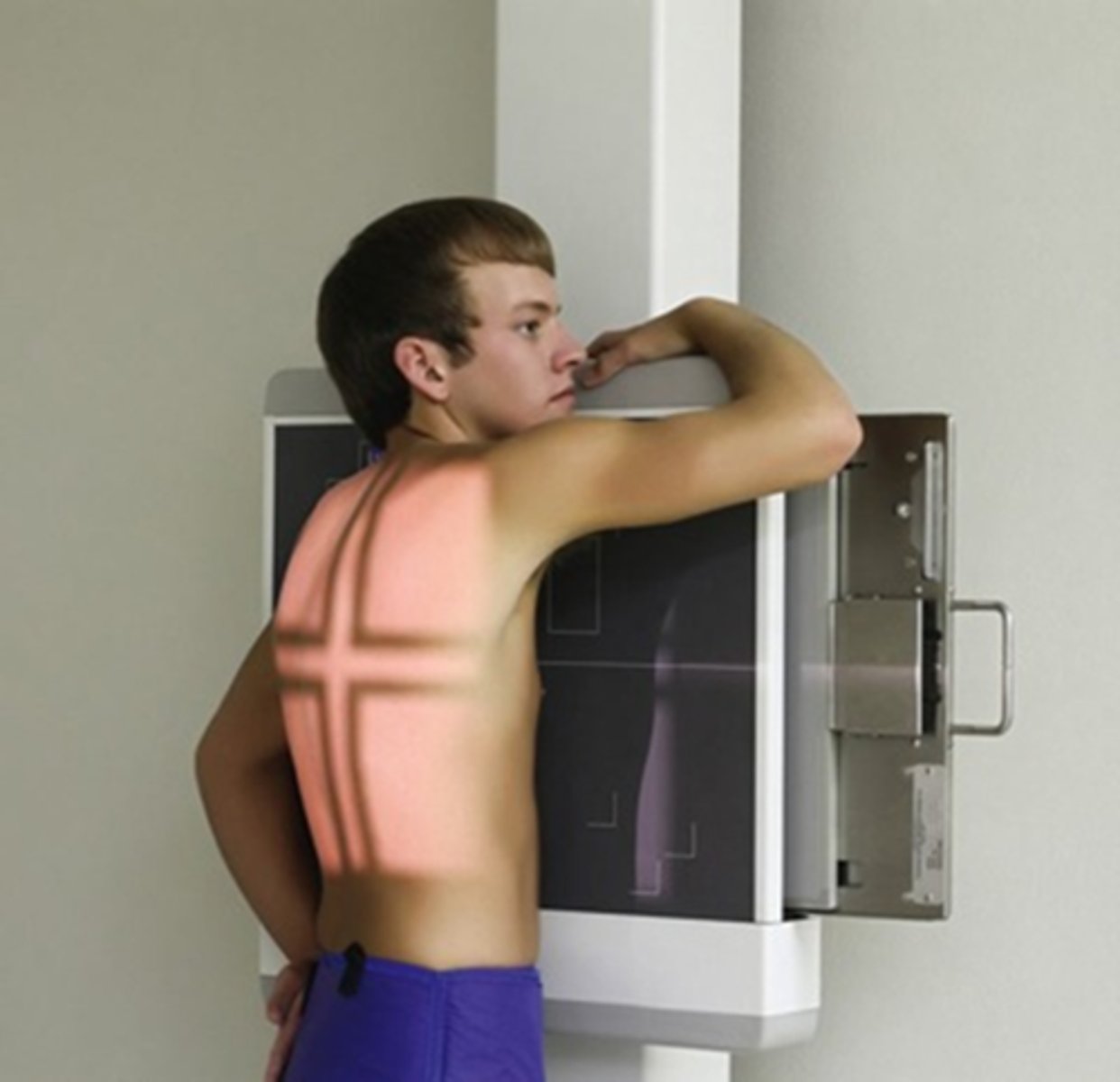 <p>angle that places left anterior portion of the body closest to the image receptor; usually 45 degree angle</p>