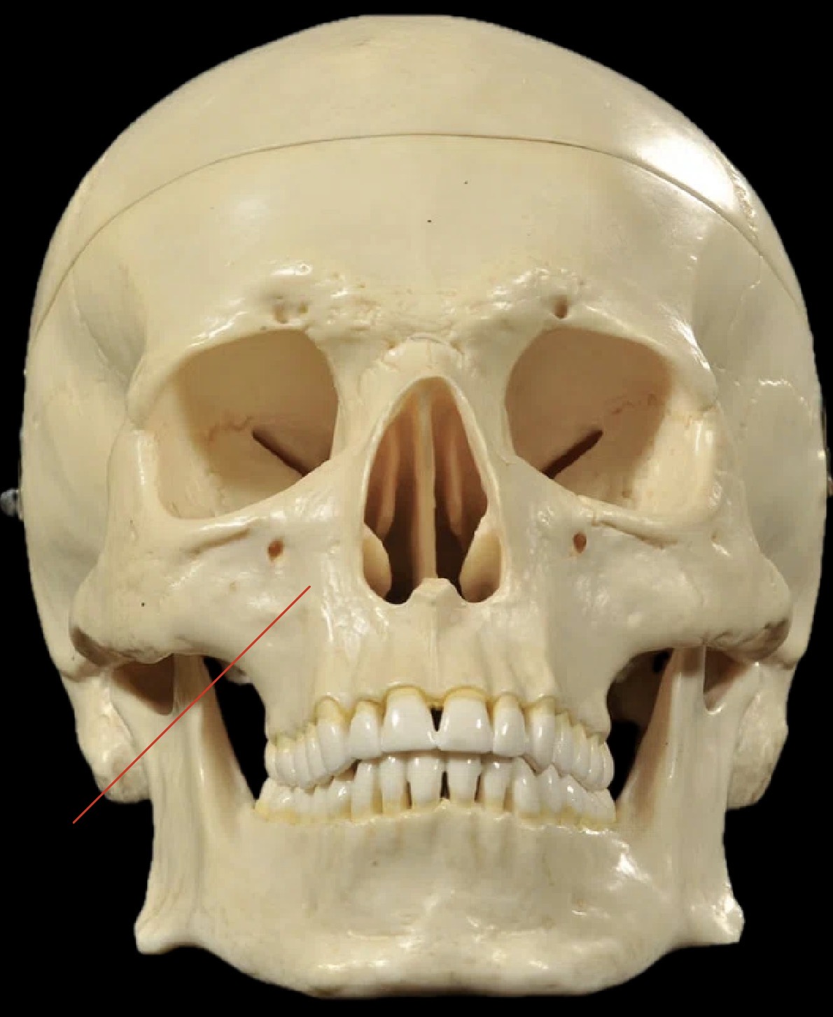 <p>What Bones are these?</p>