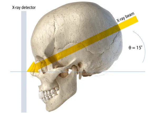<p><span>PA axial skull projection used primarily to visualize the paranasal sinuses, orbital rims, and facial bones</span></p>