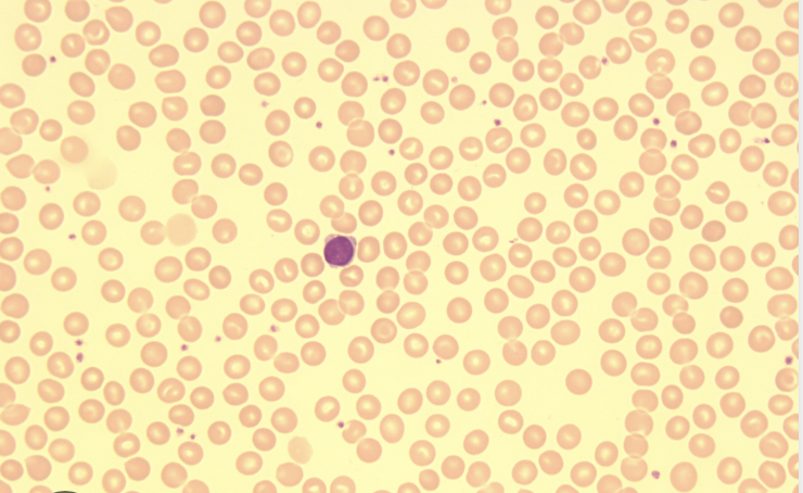 <p>What are normocytes?</p>