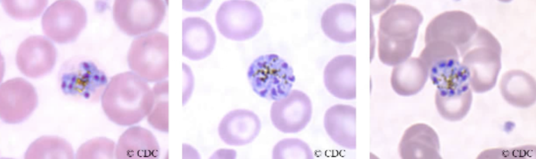 <ul><li><p><span style="background-color: transparent;">Plasmodium malaria schizont typically contains about 6 to 12 merozoites that are generally arranged in <u>rosettes</u> or irregular clusters.</span></p></li><li><p><span style="background-color: transparent;">A central arrangement of brown-green pigment may also be visible at this stage</span></p></li></ul><p></p>