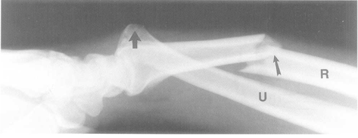 <p>What does the image show?</p>