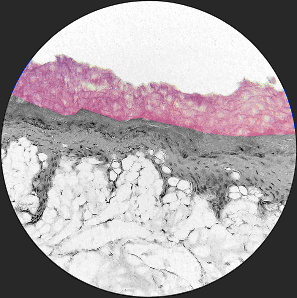 term image