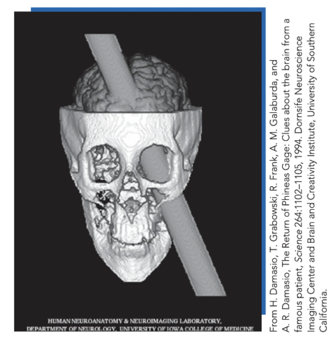 <p><strong>Role:</strong> empirical foundation (≠ competing personality theory); provides scientific findings that every personality theory must explain; supports trait theories while expanding them through evolutionary psychology and neuroscience.</p><p class="p1"><strong>Core evidence:</strong> <strong>Phineas Gage</strong> → frontal cortex damage → intelligence/language/memory preserved; personality radically altered (responsible → impulsive, irresponsible) → specific brain systems contribute causally to personality.</p><p class="p2"><strong>Research focus:</strong> biological foundations of personality via: (1) <strong>Temperament</strong>, (2) <strong>Evolutionary psychology</strong>, (3) <strong>Behavioral genetics</strong>, (4) <strong>Mood, emotion & the brain</strong>, (5) <strong>Plasticity</strong>.</p>