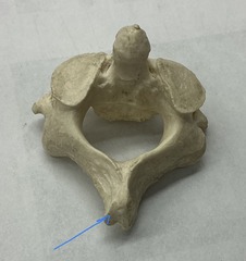 <p>What is the arrow pointing to?</p>