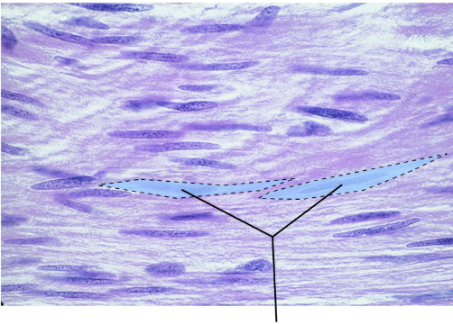 <p>What is the highlighted tissue</p>
