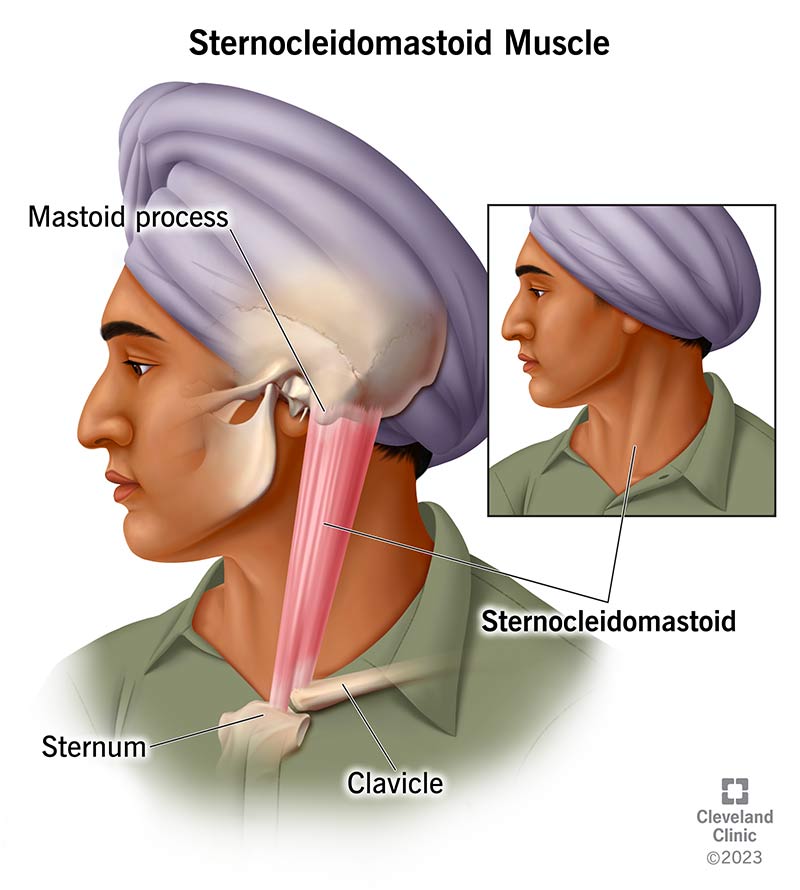 <p>Sternocleidomastoid</p>