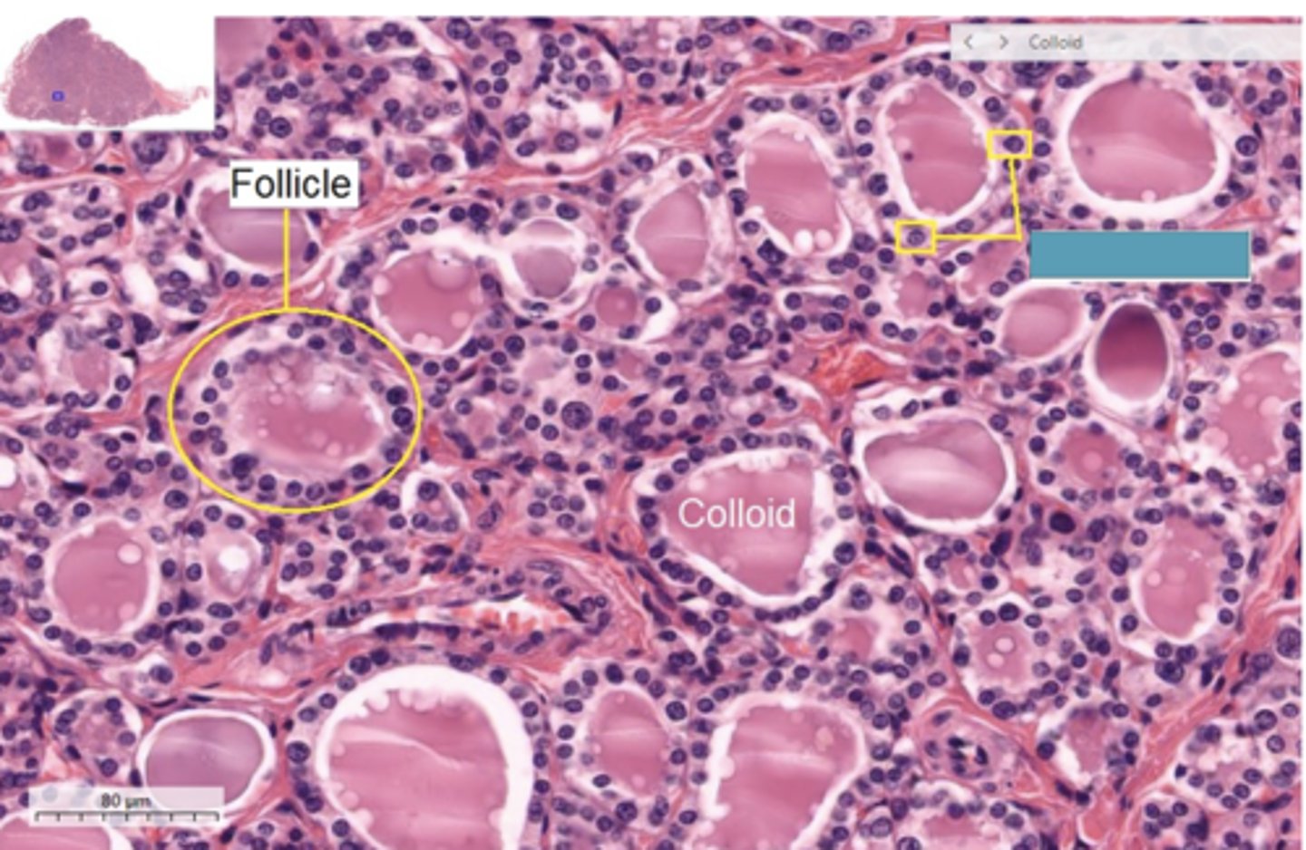 <p>Identify the cells</p>