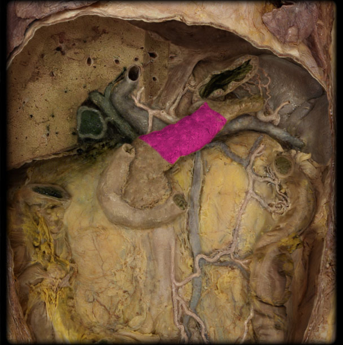 <p>Body of Pancreas</p>