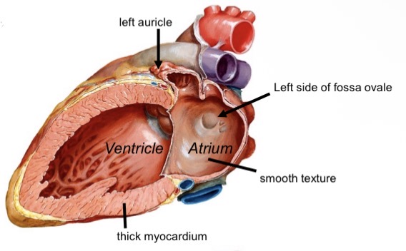 <ul><li><p>Smooth-walled chamber </p></li><li><p>Receives four pulmonary veins </p></li><li><p>Contains left auricle with pectinate muscle</p></li></ul><p></p>