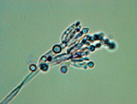 <p>Type of mold? </p>