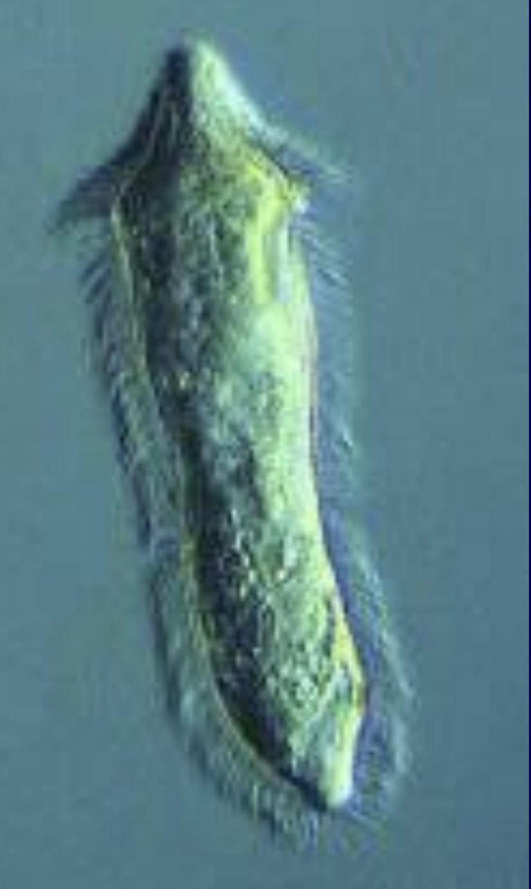 <p>What major group of Platyhelminthes does this belong to? </p>