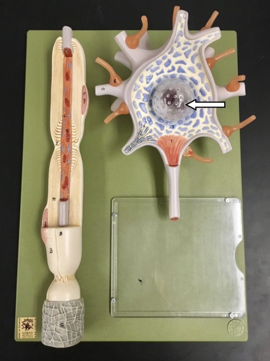 <p><span>Identify the structure indicated by the arrow (the large round ball).</span></p>