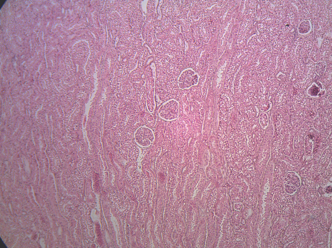 <p>What organ is seen in this image?</p>