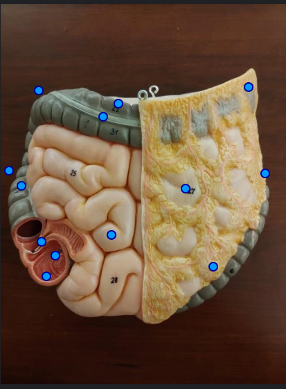 <p>Splenic Flexture </p>