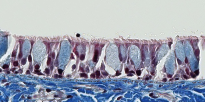 <p><span style="font-family: "Calibri Light";">ID the type of epithelium lining the surface of this tissue.</span></p>