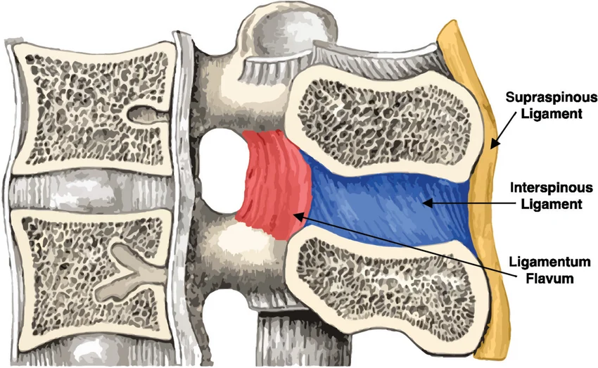 <p>ligament of flava; lamina of the individual vertebra</p><p>lnterspinious ligament; spinous process</p><p>lntertransverse ligament; transverse process</p><p>supraspinous ligament; tip of the spinous from cervical vert-sacral vert</p><p>nuchal ligament;cervical ver</p>