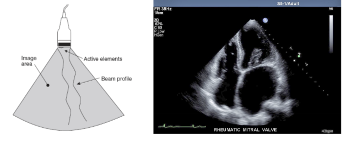 <ol><li><p>all elements are fired simultaneously</p></li><li><p>beam is electronically focused and steered</p></li><li><p>used in cardiac and brain imaging</p></li></ol><p></p>