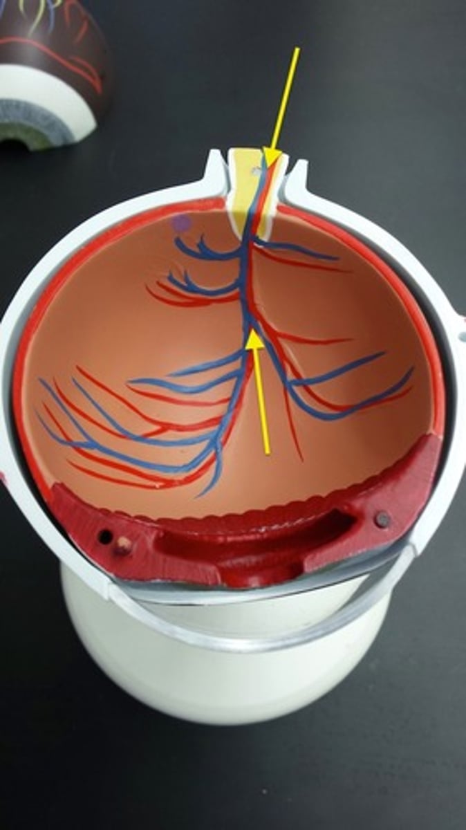 <p>What part of the eye is this?</p>