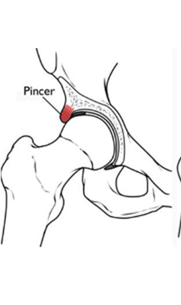 <p>Females</p>