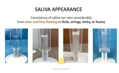 <p>Clear and free flowing to thick, stringy, sticky, or foamy</p>