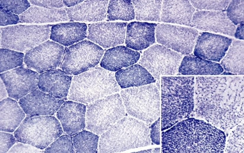 <p>What are the two types of fiber seen in this image?</p>
