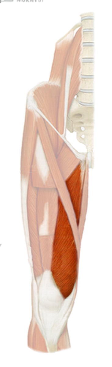 <p>Vastus Medialis</p>