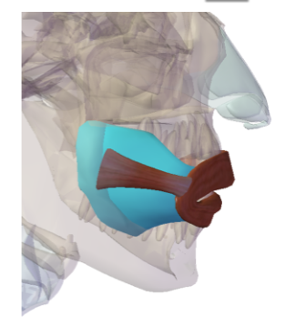 <p>Buccinator: Origin </p>