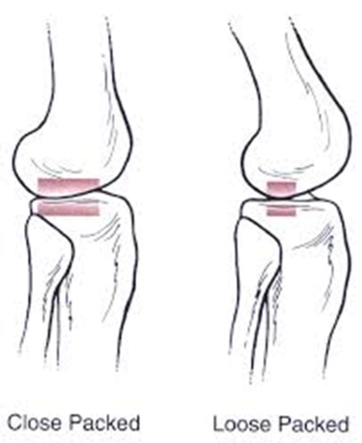 <p>Joint alignment where the joint surfaces have maximum contact with one another &amp; the surrounding ligaments and joint capsule (AKA the area between joint surfaces) are tightly compressed</p><p>ex. knee joint during knee flexion </p>