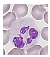 <p>- Reduction in size during differentiation</p><p>.</p><p>Contain fine granules (azurophilic)</p><p>- Primary and secondary (specific) cytoplasmic</p><p>- Contain enzymes involved in "killing"</p><p>.</p><p>- Neutrophil nucleus segments (2 -5 segments); females have drumstick-like appendage (20%)</p><p>- Neutrophil migrates to tissue</p><p>- 9-15 micrometre diameter</p><p>- Phagocytic function</p><p>.</p><p>- dont stay in the blood for too long, they have transient function because their role is to phagocytose and remove invading pathogens and organisms</p>