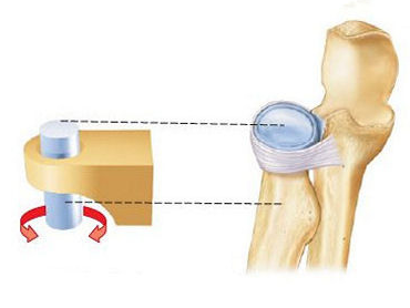 <p>bone spins or rotates in a longitudional axis. the moving bone rotates within a ligament and the bone it is articulating with</p>