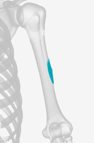 <p>What part of the humerus is this? (Left)</p>