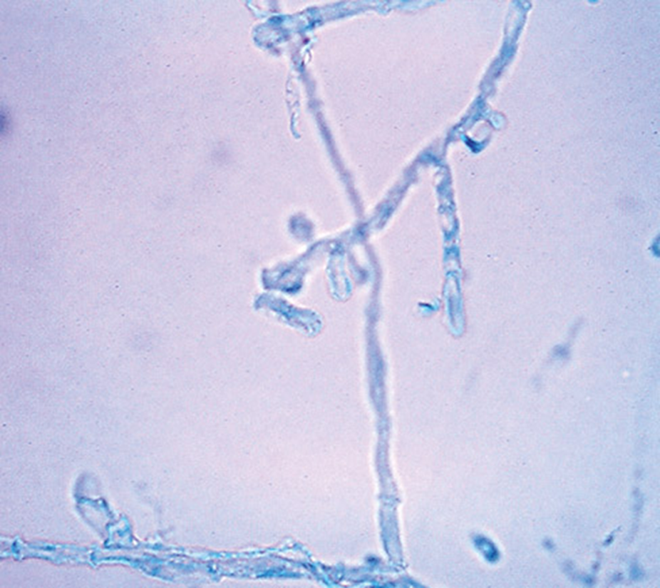 <p>Identify this fungus</p>