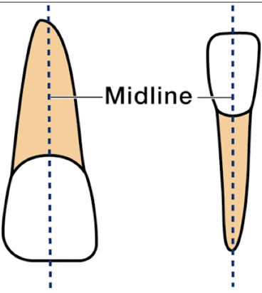 <p>The line that divides the tooth into two equal halves</p>