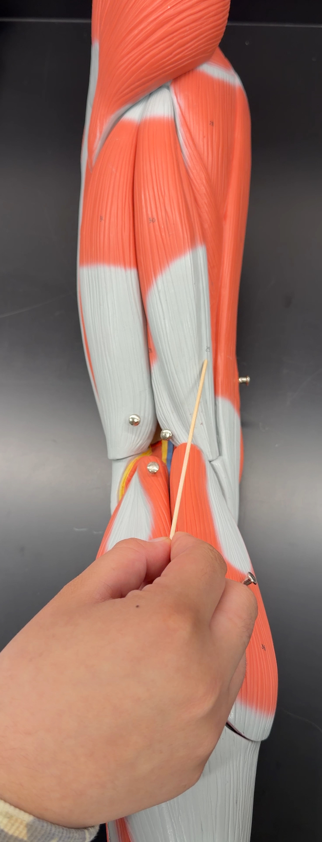 <p>name the muscle</p>
