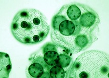 <p>This green algae has a large, circular shape with internal organelles present</p>