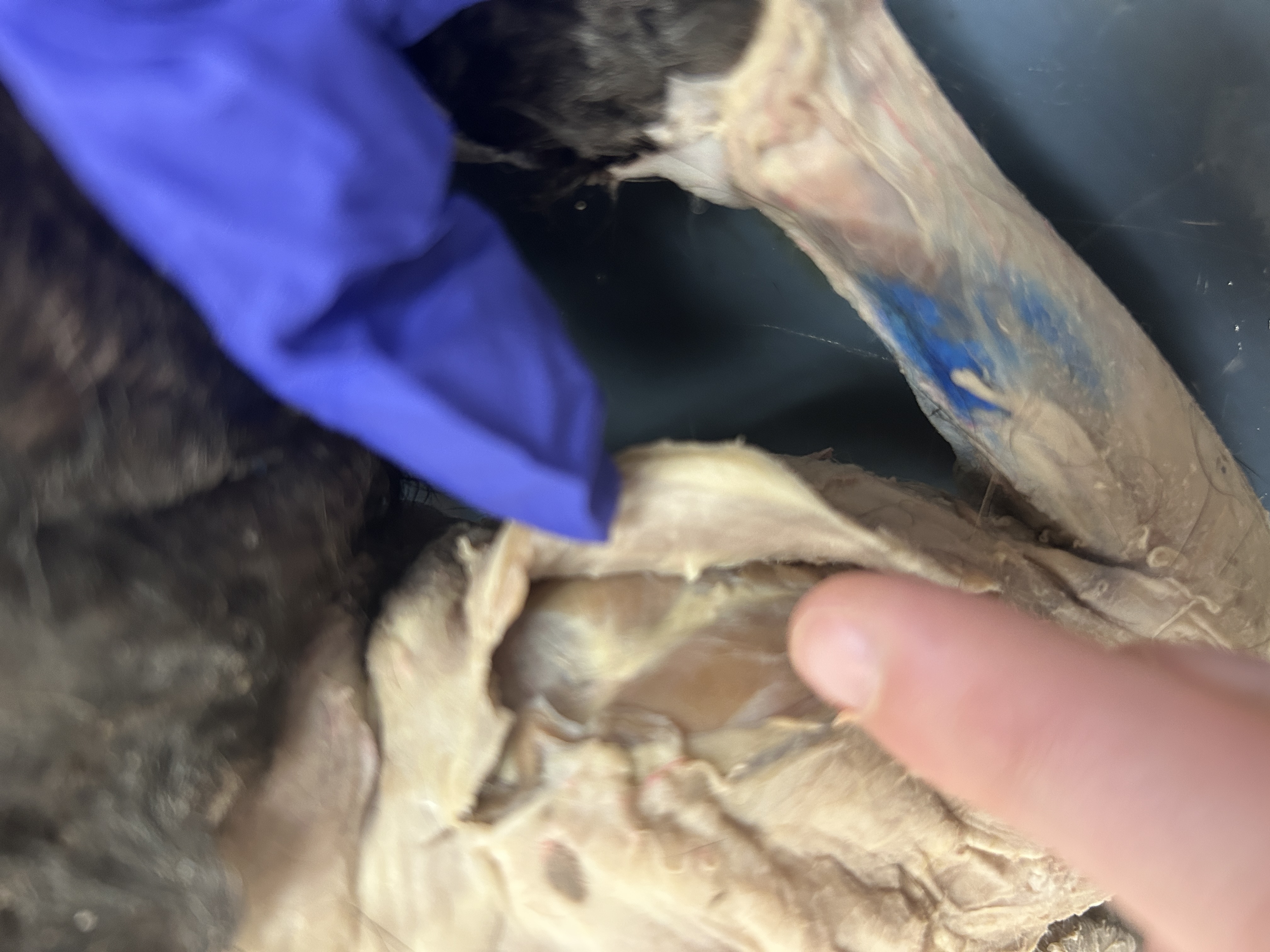 <p>Acromiodeltoid(directly on shoulder)</p>